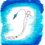 Tubus rettet Leben; Heike C. Ewert