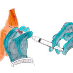 PDA Anlage; Heike C. Ewert