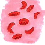 „Sichelzellkrankheit“; Heike C. Ewert